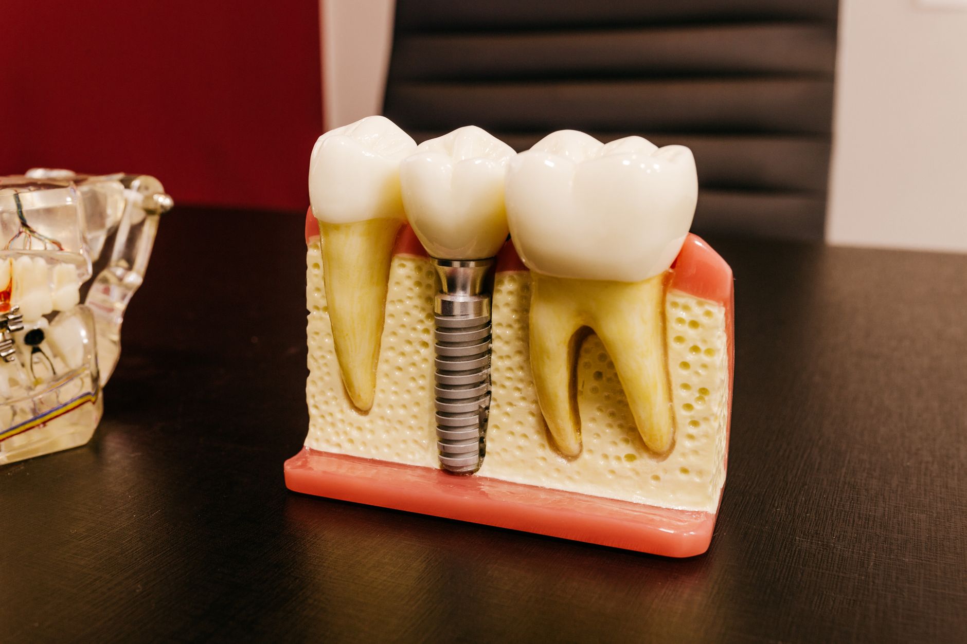 Implantes dentários — foto: Jonathan Borba/Pexels